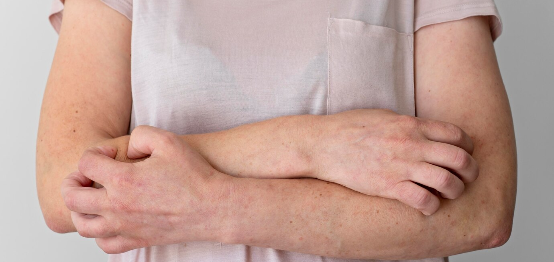 Saksham Ayurveda - Ayurvedic Treatment for Skin Diseases